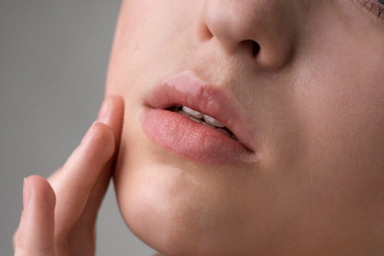 lip care